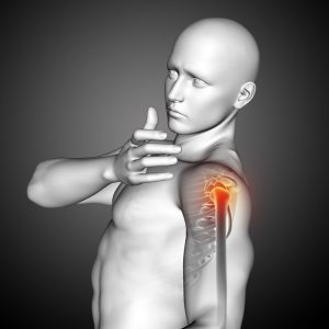 Chronic Shoulder Joint Pain Relief Solutions Today
